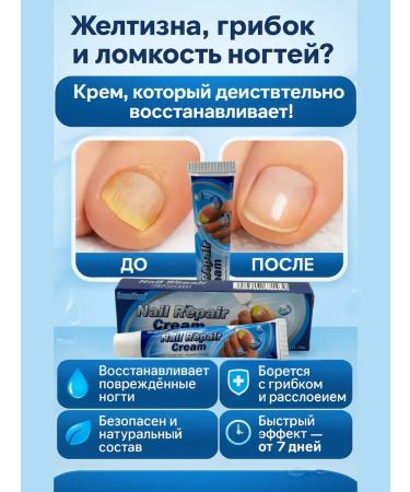 ayasof Cream from nail fungus Ointment Chinese