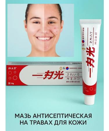 Masalievaa1 Natural herbal facial ointment for skin inflammation