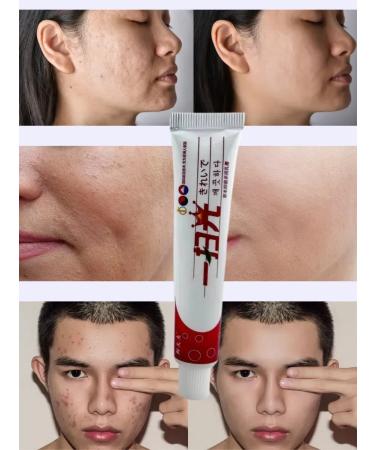 Masalievaa1 Natural herbal facial ointment for skin inflammation - Buy Online on GoSupps.com