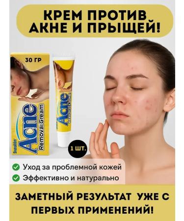 OLBY Acne cream and acne on the face