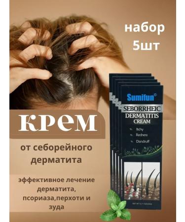 alma2 Effective 5pcs of dandruff cream of seborrheic dermatitis