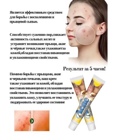 Barynch Cream from acne acne acne black spots and face inflammations - Buy Online on GoSupps.com