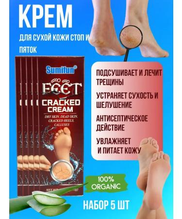 alma2 Cream for dry skin of heels from cracks 5pcs moisturizing