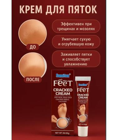 Masalievaa Cream from cracks on heels 5 pcs - Buy Online on GoSupps.com