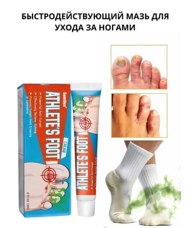 Barynch Ointment from the fungus between the fingers on the legs and feet and the smell of the legs