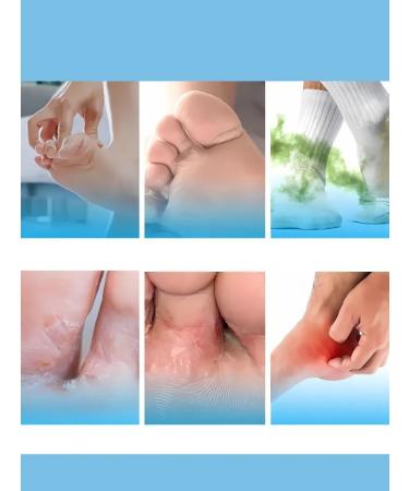 Barynch Ointment from the fungus between the fingers on the legs and feet and the smell of the legs - Buy Online on GoSupps.com