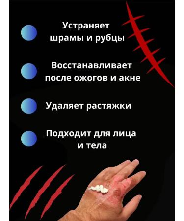 Kalis Cream ointment for removing scars and scars - Buy Online on GoSupps.com