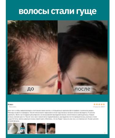 LYDIMOON Shampoo for women from hair loss and itching 300 ml - Buy Online on GoSupps.com