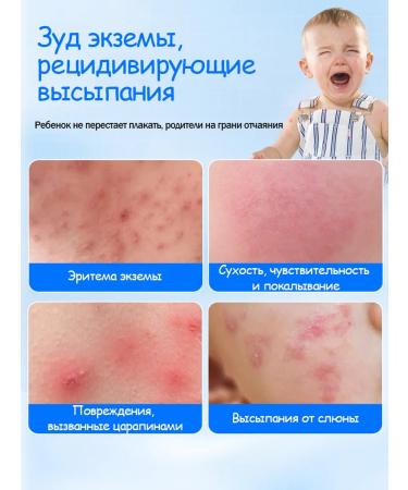 Ephlics Children's cream for newborns from eczema 50g - Buy Online on GoSupps.com