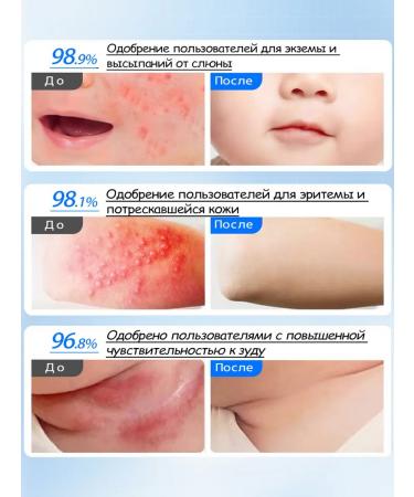 Ephlics Children's cream for newborns from eczema 50g - Buy Online on GoSupps.com