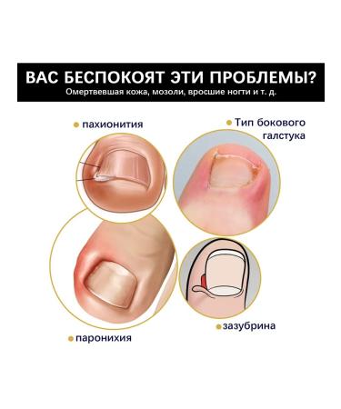 eelhoe Anti -Nogan Danger Pressword Essence Soften the Pain - Buy Online on GoSupps.com