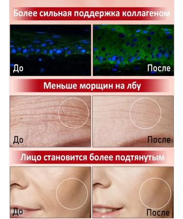 LYDIMOON Face cream anti -aging from wrinkles 5 bottles - Buy Online on GoSupps.com