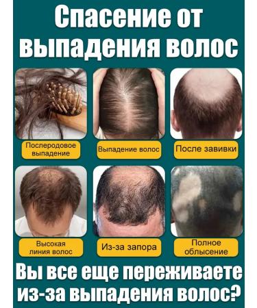 LYDIMOON Hair dropping shampoo and hair growth 300ml - Buy Online on GoSupps.com