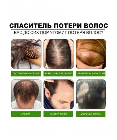 Northern lights South Moon Solvement for Hair Growth2 - Buy Online on GoSupps.com