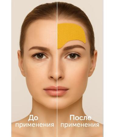 TIA Anti -aging patches for foreheads from wrinkles 3 - Buy Online on GoSupps.com