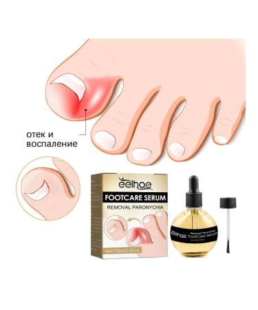 Repair essence for treats ingrown nails and fungal infections - Buy Online on GoSupps.com