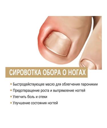 Repair essence for treats ingrown nails and fungal infections - Buy Online on GoSupps.com