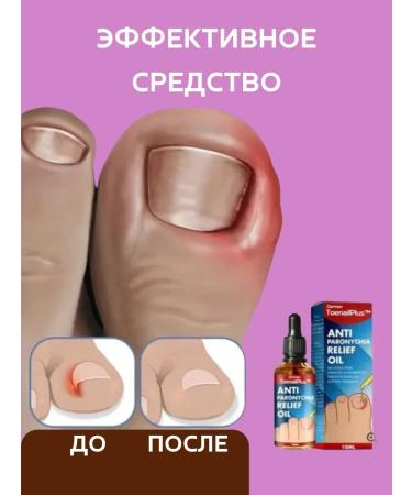 olgaintensive Oil with an ingrown nail and paronichia antiseptic+anesthetic - Buy Online on GoSupps.com