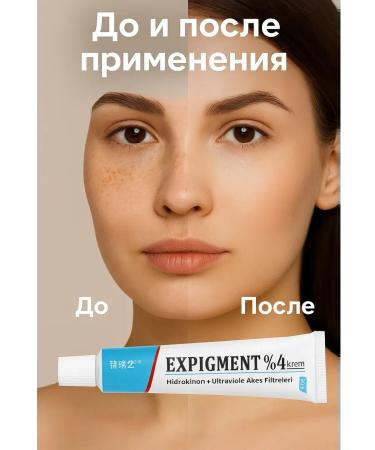 olgaintensive Whitening cream from pigmentation and freckles