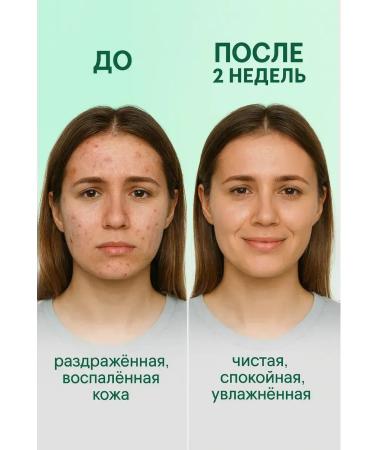 Gulka90 Wheezero for the face - Buy Online on GoSupps.com