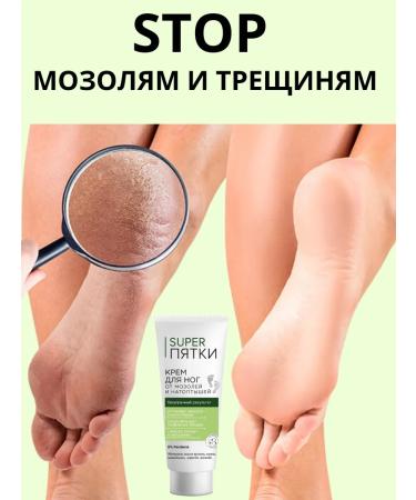 Feet cream from corns and corns 75 ml - Buy Online on GoSupps.com