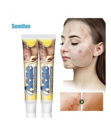 GChe Acne and rashes for problem skin - Buy Online on GoSupps.com