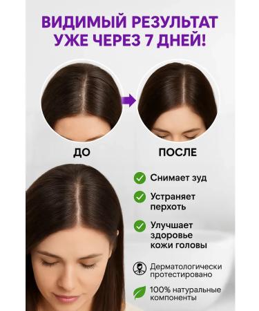 Ranyuk Hard shampoo from hair loss dandruff cream - Buy Online on GoSupps.com