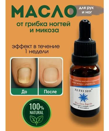 NevaNeva Oil fungus and mycosophage medicinal