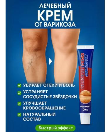 Ranyuk Cream for leg and veins against severity and edema