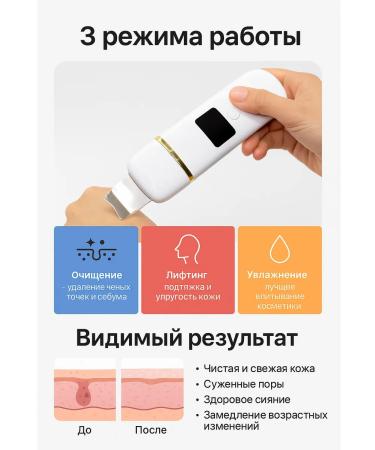 KN90 Ultrasonic Facial Skraber Kalo 8817
