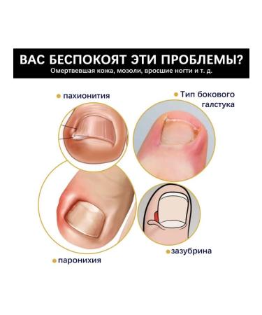 eelhoe nails of grooves Essence suppress fungi - Buy Online on GoSupps.com