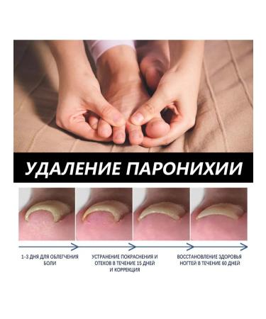 eelhoe nails of grooves Essence suppress fungi - Buy Online on GoSupps.com