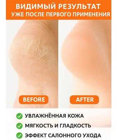 GOOSE Herbal bath for legs with natural essential oils - Buy Online on GoSupps.com