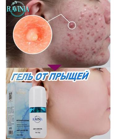 Poppy pimples 30 g of pimples of plant extract