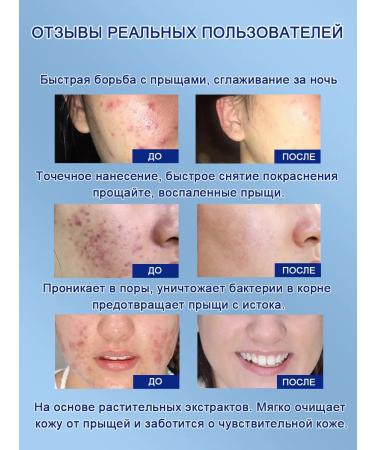 Poppy pimples 30 g of pimples of plant extract - Buy Online on GoSupps.com