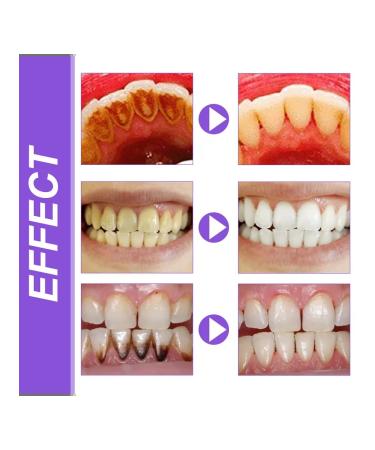 Eelhoe lysozyme toothpaste for tooth a violet 3 pcs - Buy Online on GoSupps.com