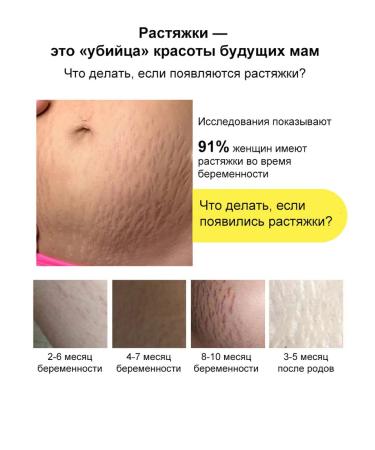 Aichun Body lotion for pregnant women - Buy Online on GoSupps.com