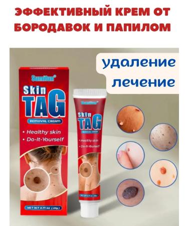 BiuG Papilloma removal and warts moles