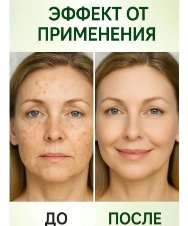 ASYA LAB2 Facing serum elimination of pigmentation even skin tone - Buy Online on GoSupps.com