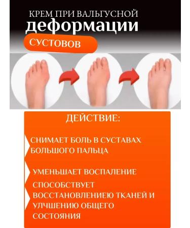 DavidSon2017 Cream for valgus joint deformation 3 pcs - Buy Online on GoSupps.com