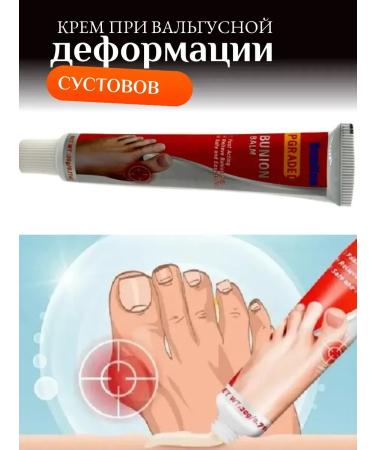 DavidSon2017 Cream for valgus joint deformation 3 pcs - Buy Online on GoSupps.com