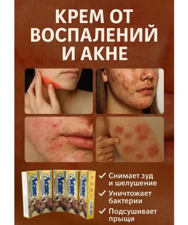 Teon Acne cream and acne against inflammation 3 pcs - Buy Online on GoSupps.com