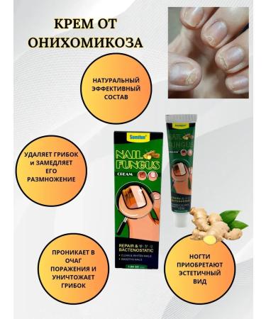 zoomba Nail fungus cream 3pcs - Buy Online on GoSupps.com