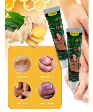 zoomba Nail fungus cream 3pcs - Buy Online on GoSupps.com