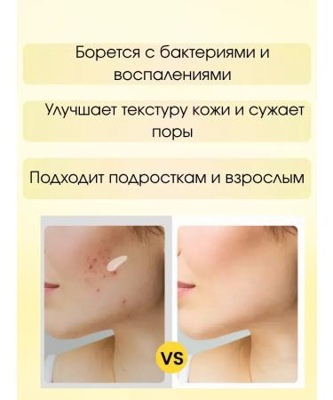 SoSo 5 acne creams - Buy Online on GoSupps.com