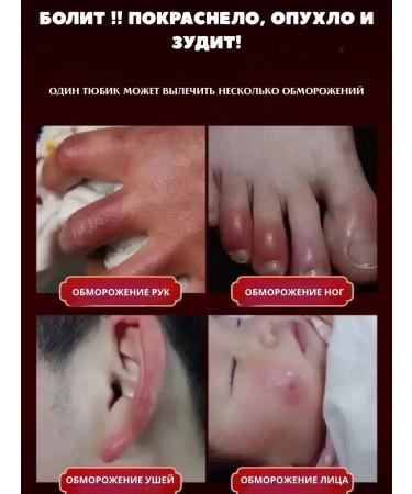 Cream from cracks and frostbite - Buy Online on GoSupps.com