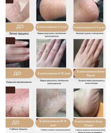 Cream from cracks and frostbite - Buy Online on GoSupps.com