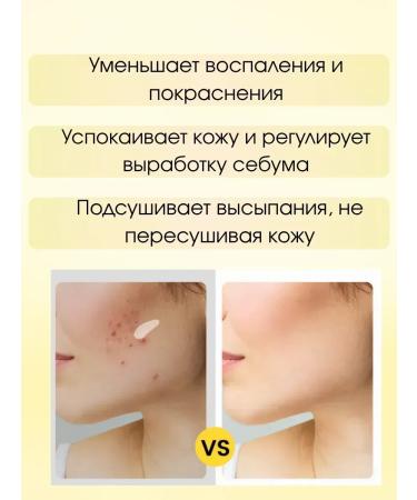SoSo 3 acne creams - Buy Online on GoSupps.com
