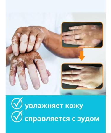 AZHAR Vitiligo cream and pigment spots set 3pcs - Buy Online on GoSupps.com