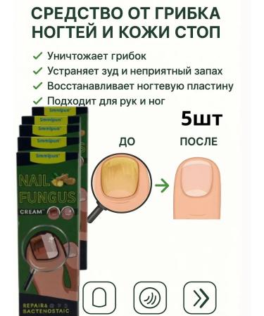 Zhyldyz Remedy for nail fungus and skin 5pcs